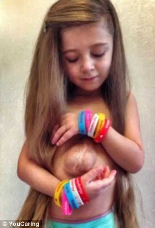 Meet The Girl Born With Her Heart Outside Her Chest (See Photos)